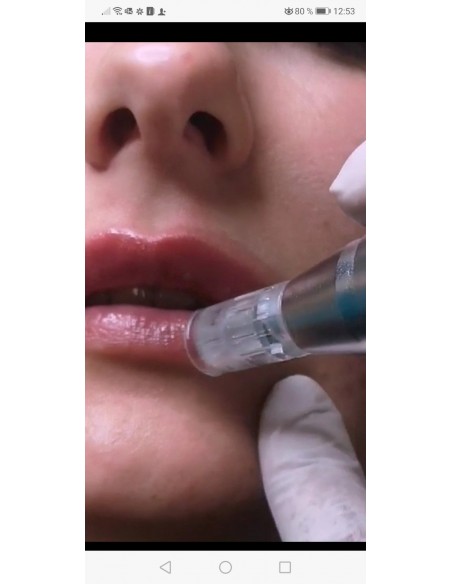 Efecto push-up labios rejuvenecidos y voluminados