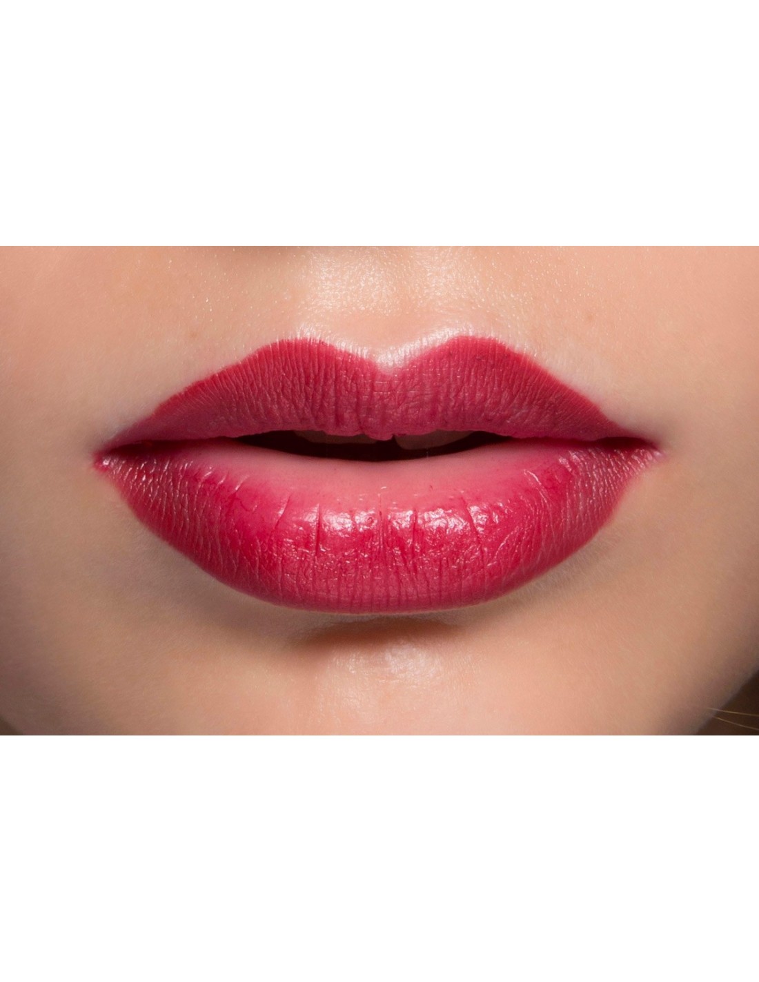 3D lips rejuvenation and volume in a single pass