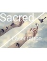 laser eliminacion de tattoo